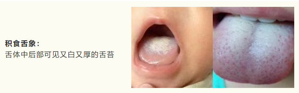积食图2.png